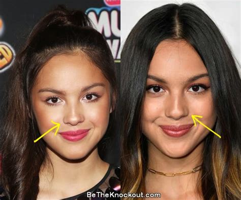 does olivia rodrigo have implants|What is off about olivia rodrigo appearance that。